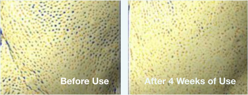Clinical skin surface uniformity imaging comparing before use and after four weeks of ampoule use